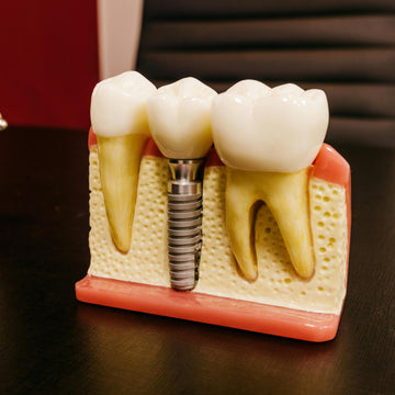 Implant