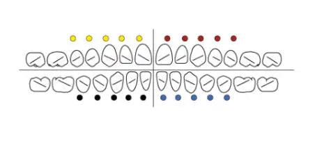 Axcess Bracket  - GC
