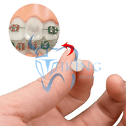 Orthodontic Wax - Egypt