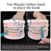 العصابات المطاطية الغرينية