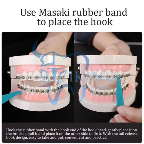 العصابات المطاطية الغرينية