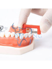 IPR Striping System - Easy in Smile