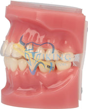 المطاطية داخل الفم - أورثو الأمريكية