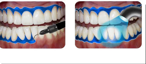 GINGIVAL BARRIER
