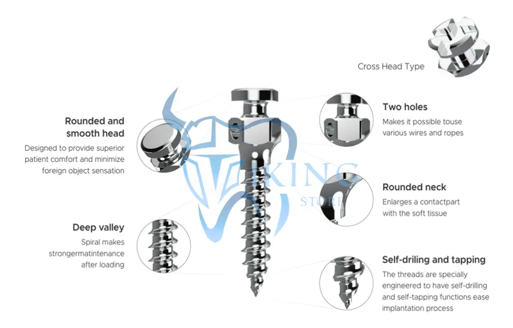 GNI Smart Anchor Mini Screw — Titanium TAD – Viking Dental Store